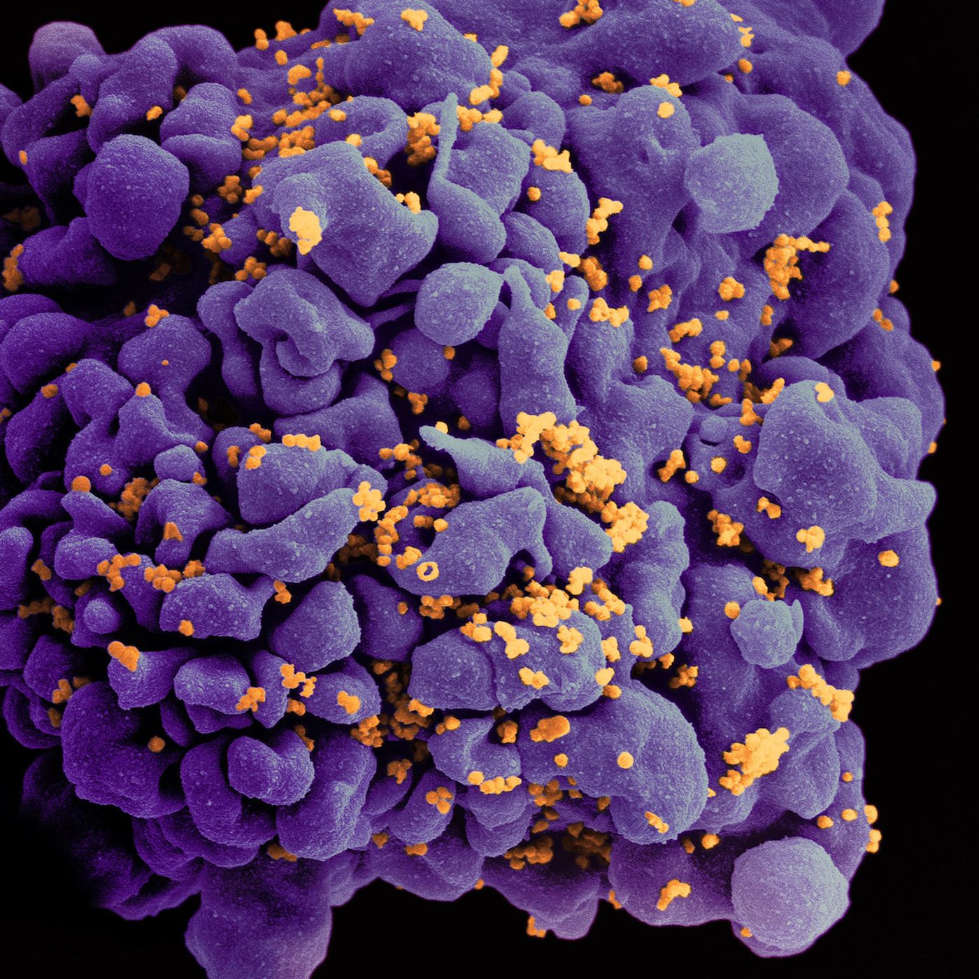 HIV-infected H9 T Cell  Scanning electron micrograph of an HIV-infected H9 T cell / Credit: NIAID