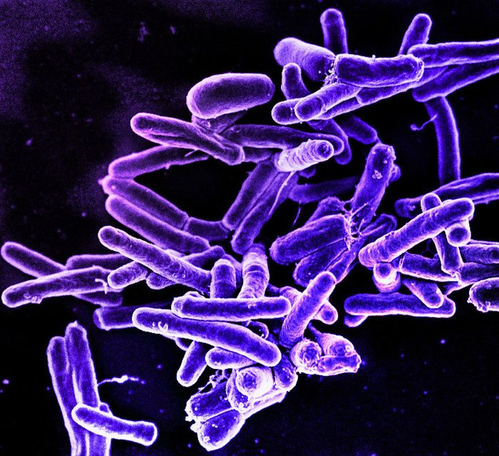 Scanning electron micrograph of Mycobacterium tuberculosis bacteria / Credit: NIAID