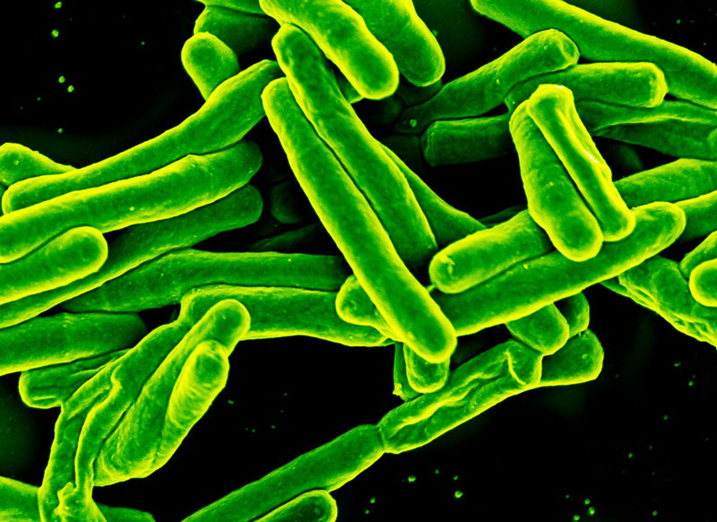 Scanning electron micrograph of Mycobacterium tuberculosis bacteria, which cause TB / Credit: NIAID