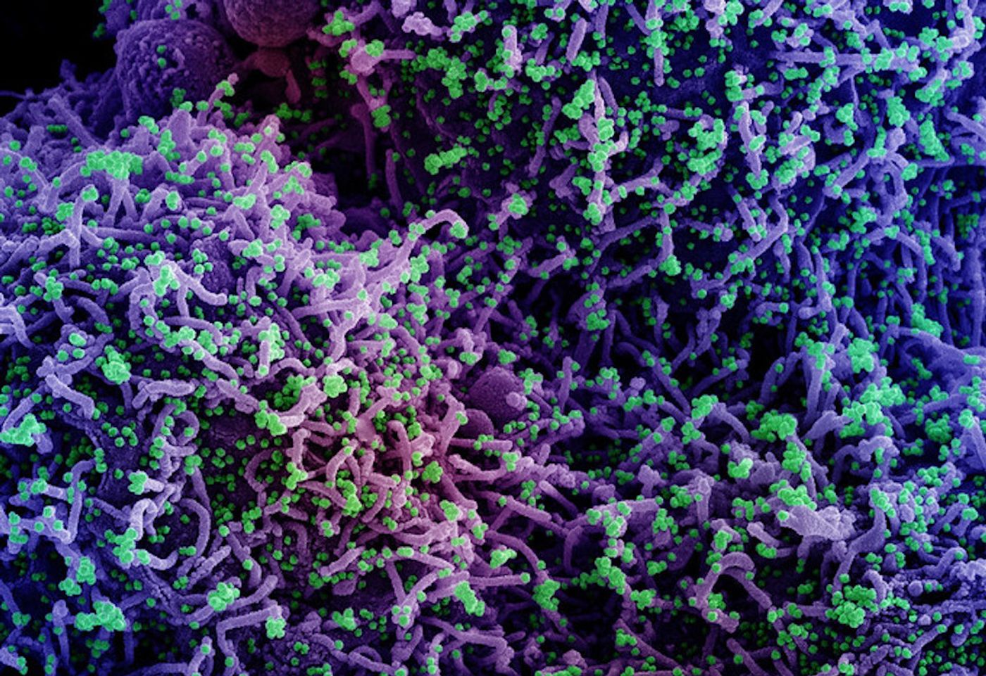 Scanning electron micrograph of a cell (purple) infected with a variant strain of SARS-CoV-2 virus particles (green), isolated from a patient sample and colorized in Halloween colors. Image captured at the NIAID Integrated Research Facility (IRF) in Fort Detrick, Maryland. / Credit: NIAID