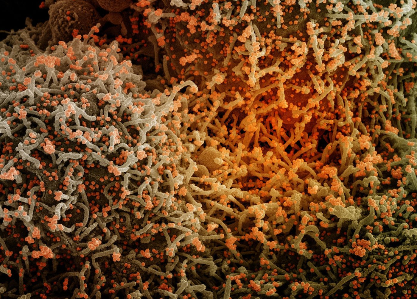 (Cropped from) A scanning electron micrograph of a cell (green) infected with a variant strain of SARS-CoV-2 virus particles (orange), isolated from a patient sample and colorized in Halloween colors. Image captured at the NIAID Integrated Research Facility (IRF) in Fort Detrick, Maryland. Stay safe and have a Happy Halloween! Credit: NIAID