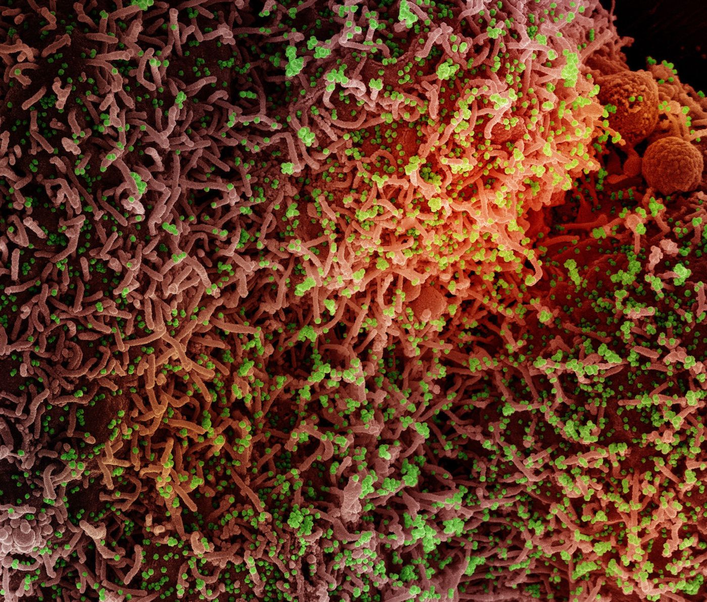 Colorized scanning electron micrograph of a cell infected with a variant strain of SARS-CoV-2 virus particles (green), isolated from a patient sample. Image captured at the NIAID Integrated Research Facility (IRF) in Fort Detrick, Maryland. Credit: NIAID