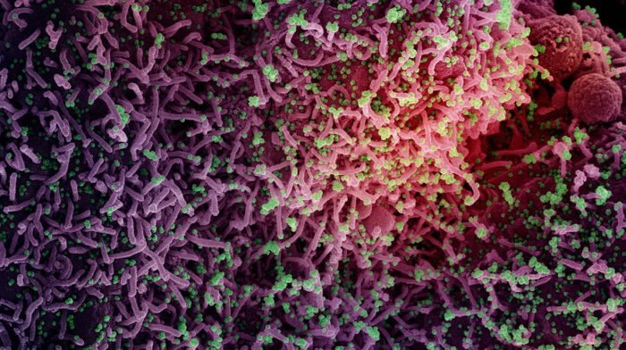 Colorized scanning electron micrograph of a cell infected with a variant strain of SARS-CoV-2 virus particles, isolated from a patient sample. Image captured at the NIAID Integrated Research Facility (IRF) in Fort Detrick, Maryland. / Credit: NIAID