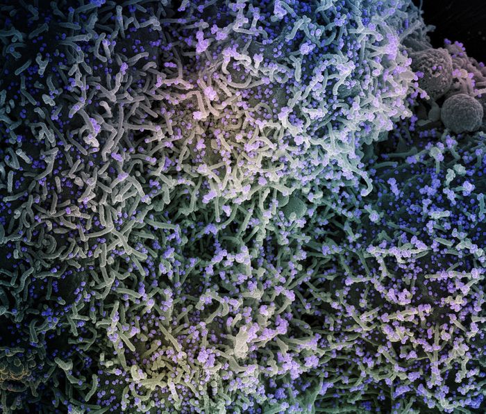 Colorized scanning electron micrograph of a cell infected with a variant strain of SARS-CoV-2 virus particles (purple), isolated from a patient sample. Image captured at the NIAID Integrated Research Facility (IRF) in Fort Detrick, Maryland. Credit: NIAID