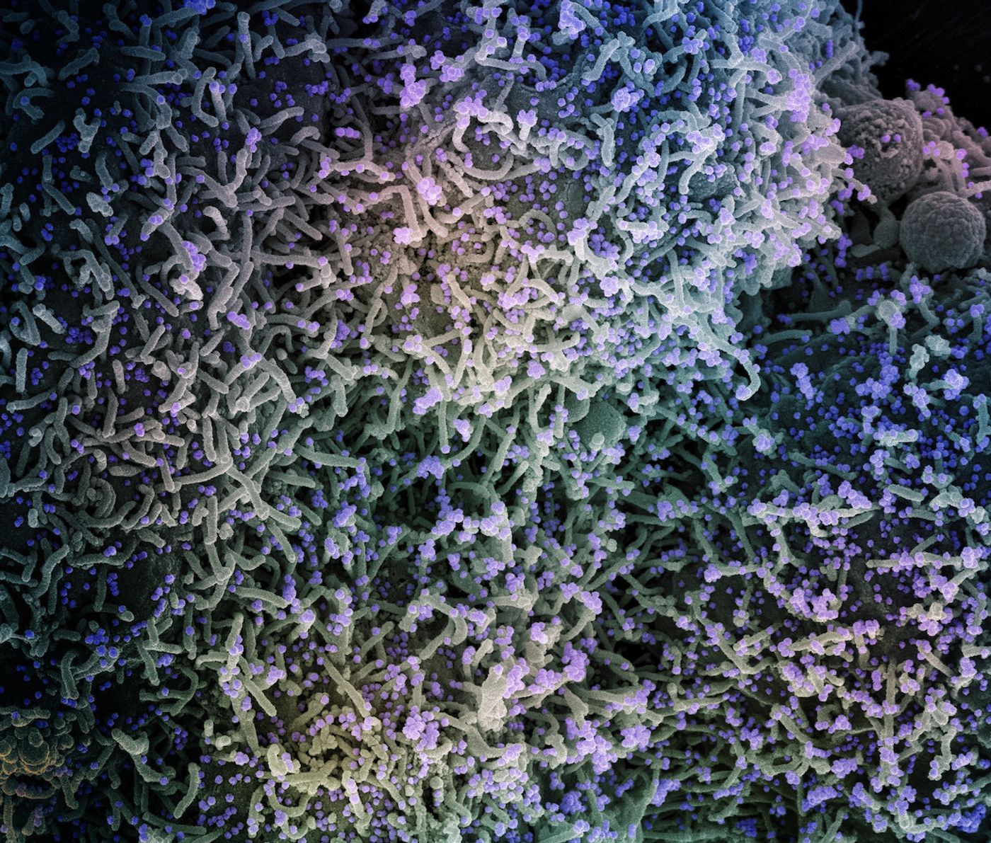 Colorized scanning electron micrograph of a cell infected with a variant strain of SARS-CoV-2 virus particles (purple), isolated from a patient sample. Image captured at the NIAID Integrated Research Facility (IRF) in Fort Detrick, Maryland. Credit: NIAID