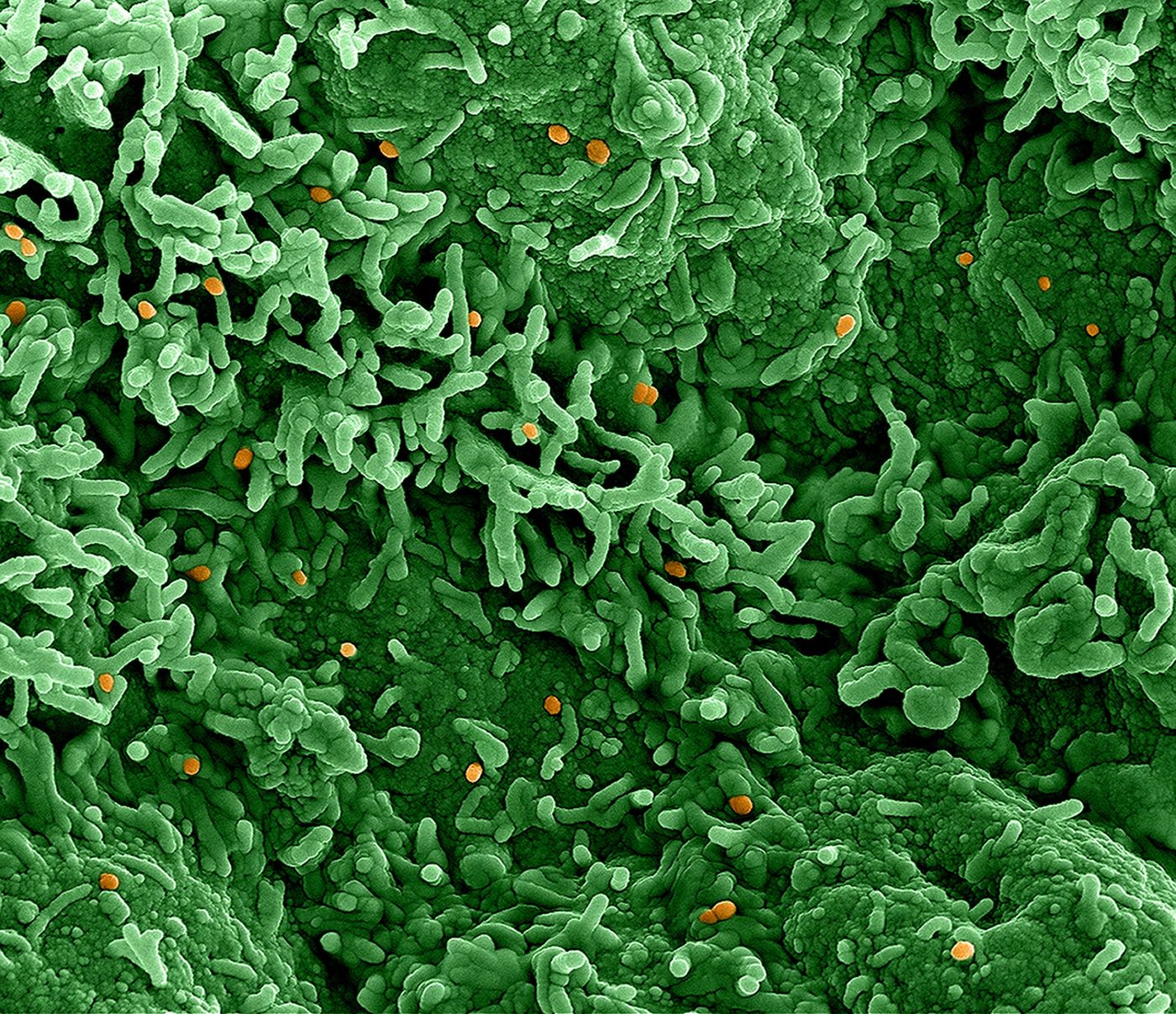 Colorized scanning electron micrograph of monkeypox virus (orange) on the surface of infected VERO E6 cells (green). Image captured at the NIAID Integrated Research Facility (IRF) in Fort Detrick, Maryland. Credit: NIAID