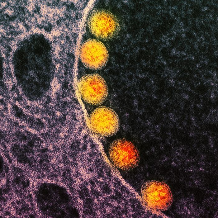 Transmission electron micrograph of SARS-CoV-2 virus particles (gold) within endosomes of a heavily infected nasal Olfactory Epithelial Cell. Image captured at the NIAID Integrated Research Facility (IRF) in Fort Detrick, Maryland. Credit: NIAID
