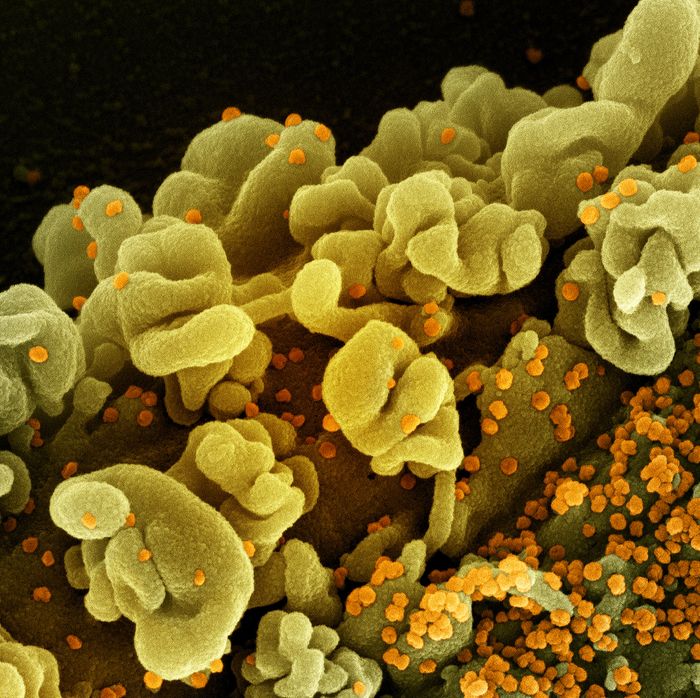 Colorized scanning electron micrograph of a cell infected with the Omicron strain of SARS-CoV-2 virus particles (orange), isolated from a patient sample. Image captured at the NIAID Integrated Research Facility (IRF) in Fort Detrick, Maryland. Credit: NIAID