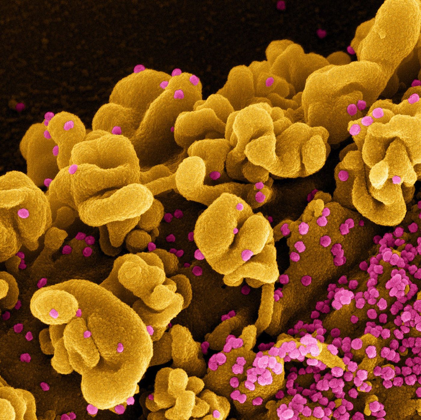 Colorized scanning electron micrograph of a cell infected with the Omicron strain of SARS-CoV-2 virus particles (pink), isolated from a patient sample. Image captured at the NIAID Integrated Research Facility (IRF) in Fort Detrick, Maryland. Credit: NIAID