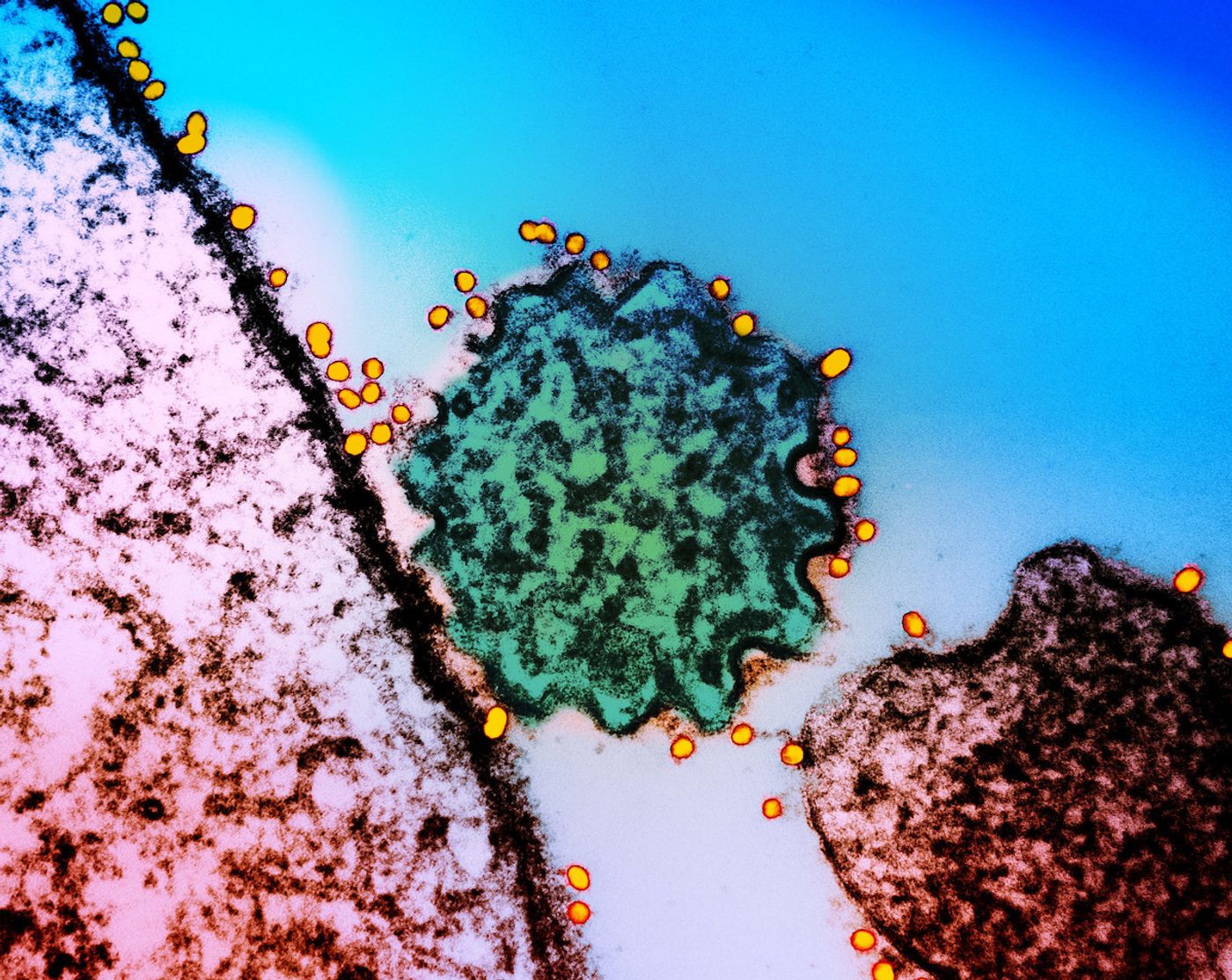 In this colorized transmission electron micrograph of a single Nipah virus particle (center, colorized green), budded from the surface of an infected cell (pink), immunogold labeling was used to label  Nipah virus surface glycoproteins. Gold particles (yellow) are bound to antibodies that recognize a specific viral antigen or epitope, which themselves bind to viral particles both within and on the surfaces of infected cells. Researchers can thus see the antibodies, and confirm the virus type in the image. / Captured at the NIAID Research Facility (IRF) in Fort Detrick, Maryland. Credit: NIAID