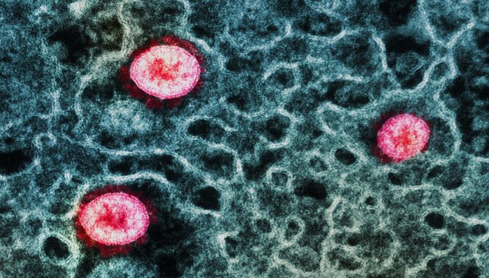 Cropped from a transmission electron micrograph of SARS-CoV-2 Omicron virus particles (pink) replicating within the cytoplasm of an infected CCL-81 cell (teal). Image captured at the NIAID Integrated Research Facility (IRF) in Fort Detrick, Maryland. Credit: NIAID