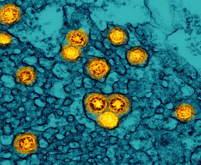Transmission electron micrograph of SARS-CoV-2 Omicron virus particles (gold) replicating within the cytoplasm of an infected CCL-81 cell (teal). Image captured at the NIAID Integrated Research Facility (IRF) in Fort Detrick, Maryland. Credit: NIAID