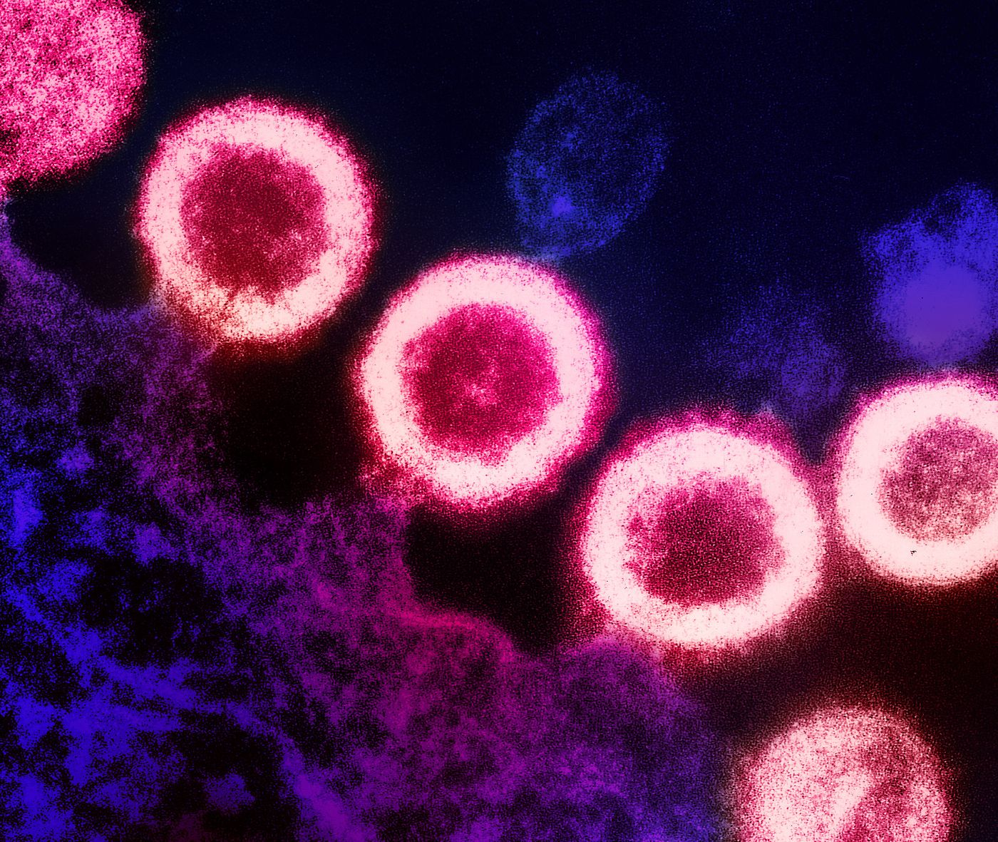 ransmission electron micrograph of HIV-1 virus particles (pink) replicating from the plasma membrane of an infected H9 T cell (purple). Image captured at the NIAID Integrated Research Facility (IRF) in Fort Detrick, Maryland. Credit: NIAID