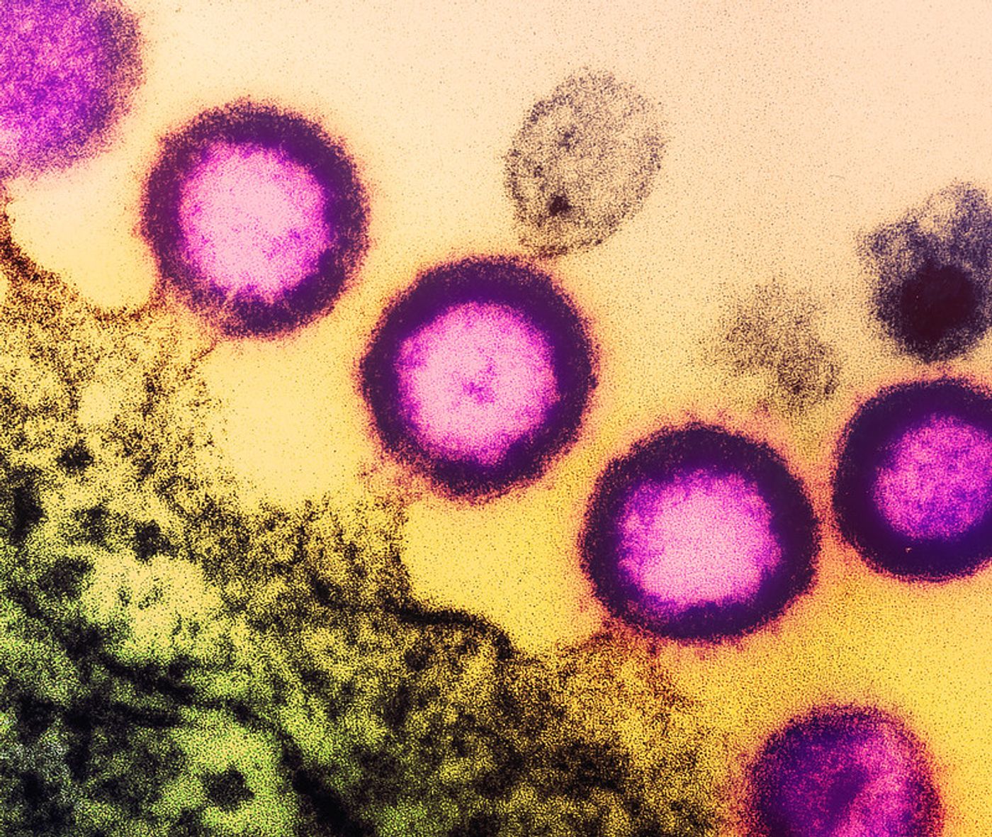 ransmission electron micrograph of HIV-1 virus particles (pink) replicating from the plasma membrane of an infected H9 T cell. Image captured at the NIAID Integrated Research Facility (IRF) in Fort Detrick, Maryland. Credit: NIAID