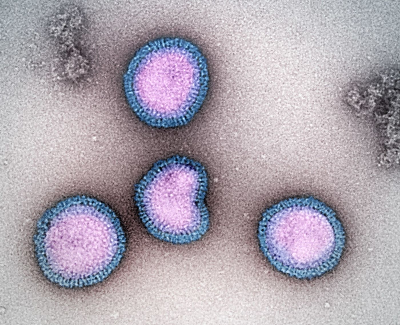 Influenza B virus particles, colorized purple and blue, isolated from a patient sample and then propagated in cell culture. / Credit: Microscopy by John Gallagher and Audray Harris, NIAID Laboratory of Infectious Diseases. / NIAID