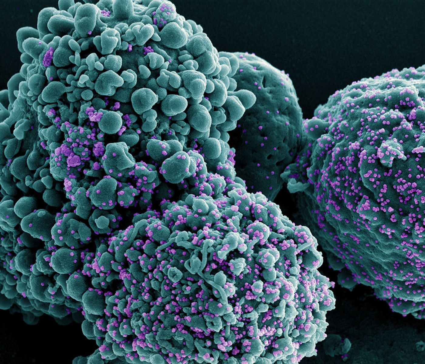 Colorized scanning electron micrograph of a cell infected with the Omicron strain of SARS-CoV-2 virus particles (purple), isolated from a patient sample. Image captured at the NIAID Integrated Research Facility (IRF) in Fort Detrick, Maryland. Credit: NIAID