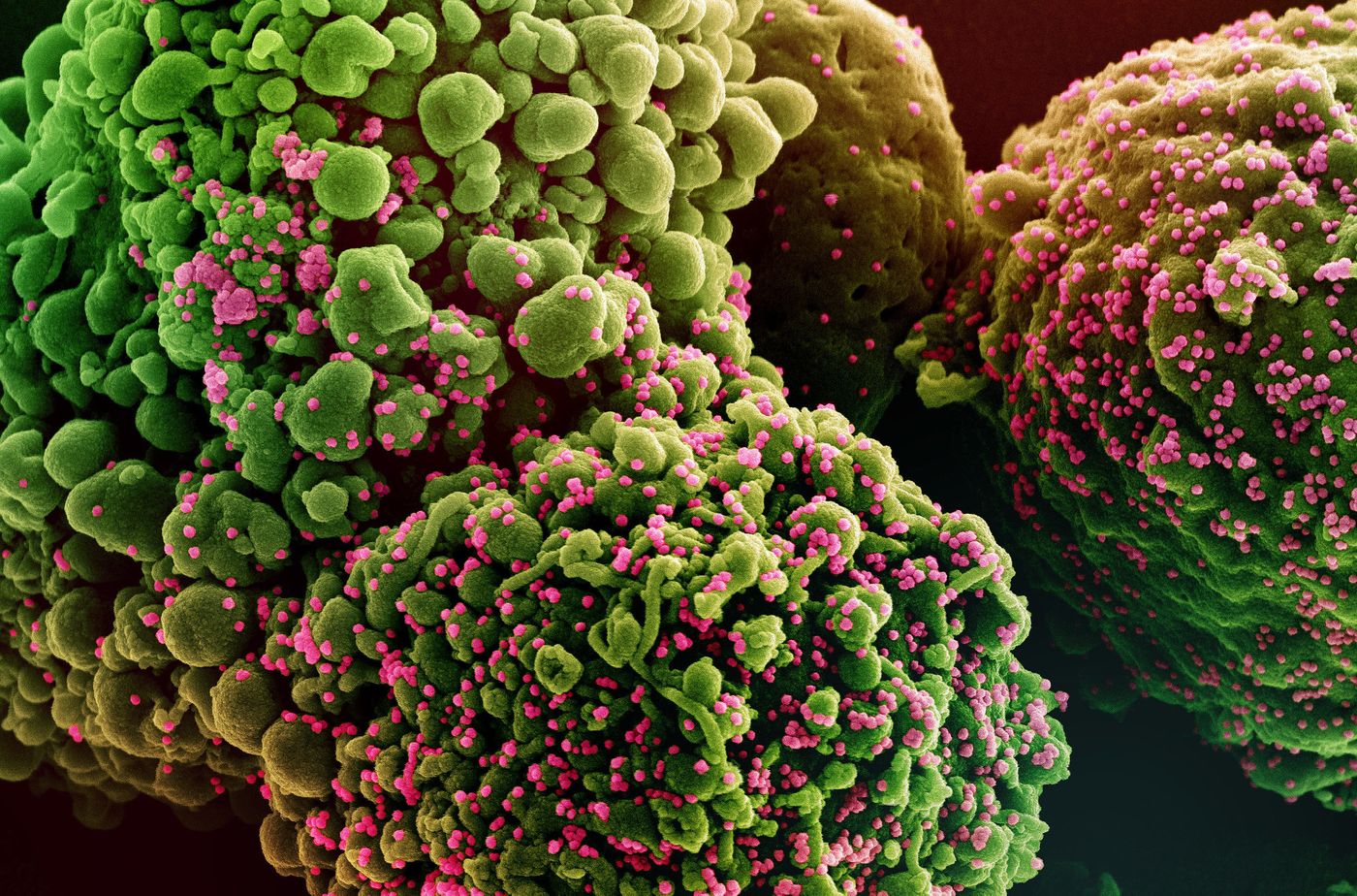 Colorized scanning electron micrograph of a cell infected with the Omicron strain of SARS-CoV-2 virus particles (pink), isolated from a patient sample. Image captured at the NIAID Integrated Research Facility (IRF) in Fort Detrick, Maryland. Credit: NIAID