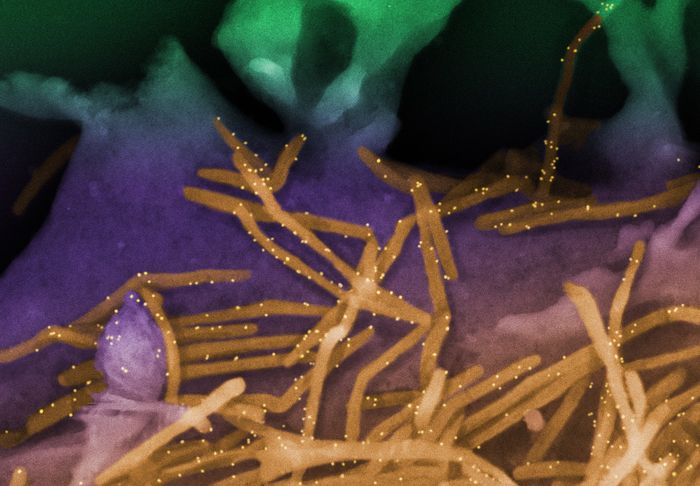canning electron micrograph of human respiratory syncytial virus (RSV), colorized in Halloween-appropriate colors. Virions (colorized gold) are labeled with anti-RSV F protein/gold antibodies (colorized yellow) shedding from the surface of human lung epithelial A549 cells. RSV is a common contagious virus that infects the human respiratory tract. Stay safe this Halloween! Credit: NIAID