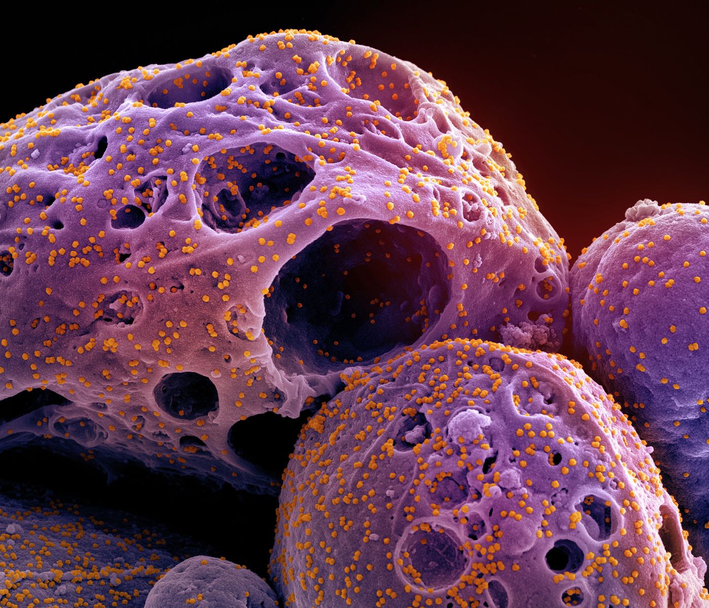 Novel Coronavirus SARS-CoV-2 (Omicron)  Scanning electron micrograph of a cell (purple) infected with the Omicron strain of SARS-CoV-2 virus particles (orange), isolated from a patient sample and colorized in Halloween-appropriate colors. Image captured at the NIAID Integrated Research Facility (IRF) in Fort Detrick, Maryland. / Credit: NIAID