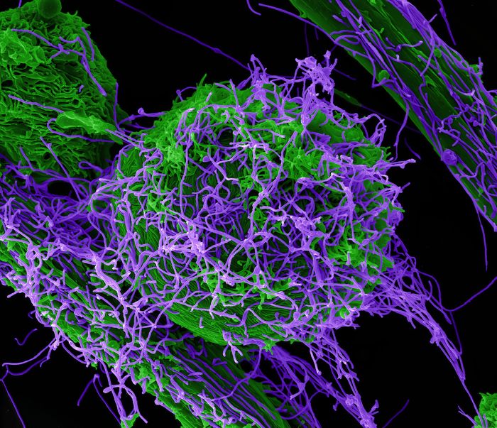 Scanning electron micrograph of Ebola virus particles (purple) both budding and attached to the surface of infected VERO E6 cells (green)/ Image captured at the NIAID Integrated Research Facility in Fort Detrick, Maryland. Credit: NIAID