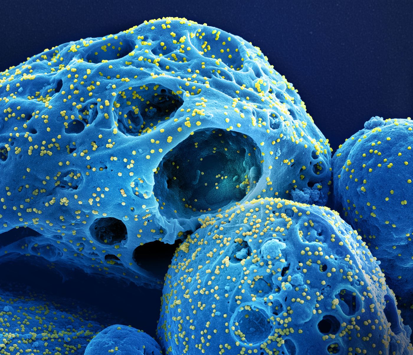 Colorized scanning electron micrograph of a cell (blue) infected with the Omicron strain of SARS-CoV-2 virus particles (yellow), isolated from a patient sample. Image captured at the NIAID Integrated Research Facility (IRF) in Fort Detrick, Maryland. Credit: NIAID