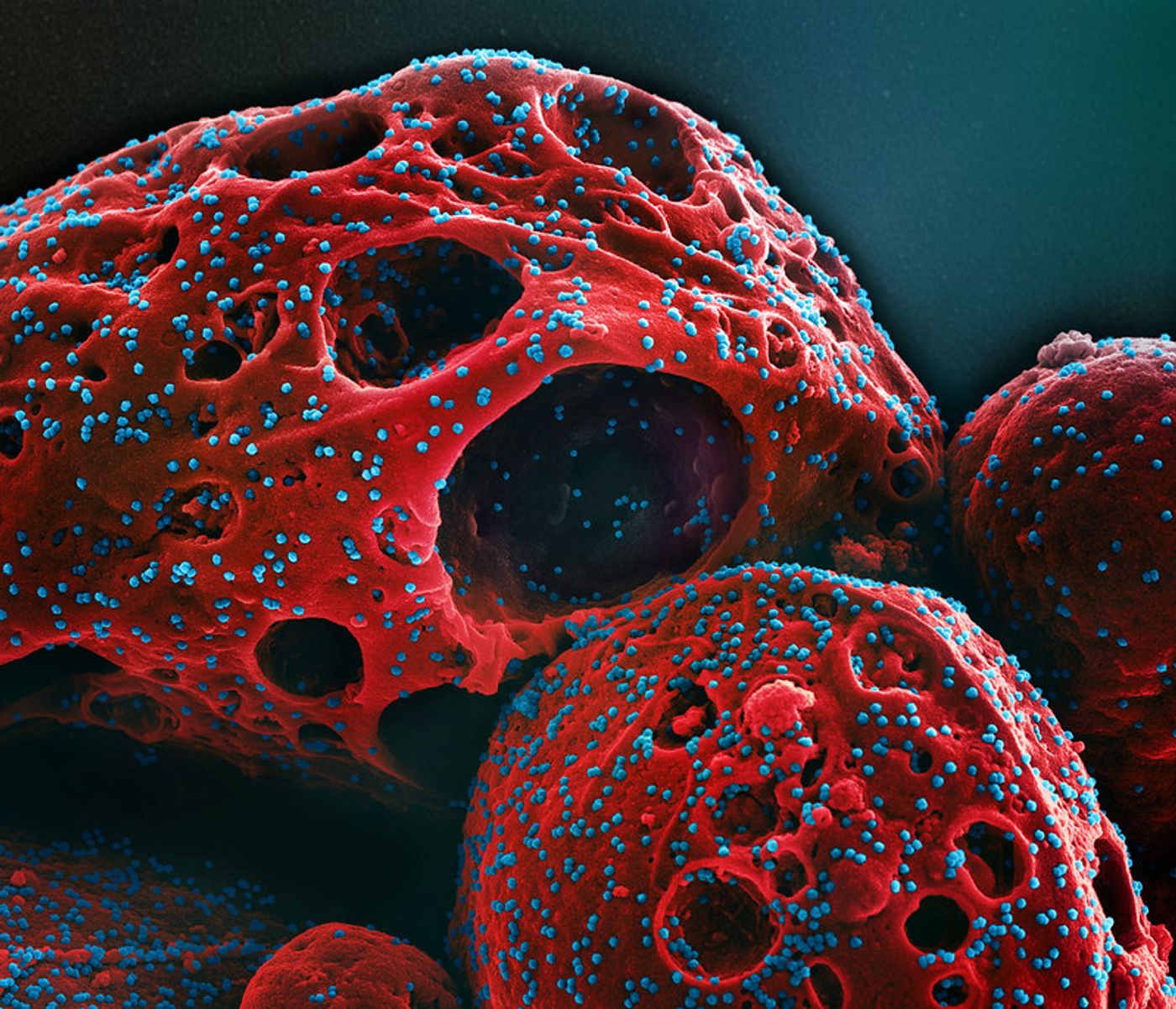 Colorized scanning electron micrograph of a cell (red) infected with the Omicron strain of SARS-CoV-2 virus particles (blue), isolated from a patient sample. Image captured at the NIAID Integrated Research Facility (IRF) in Fort Detrick, Maryland. Credit: NIAID