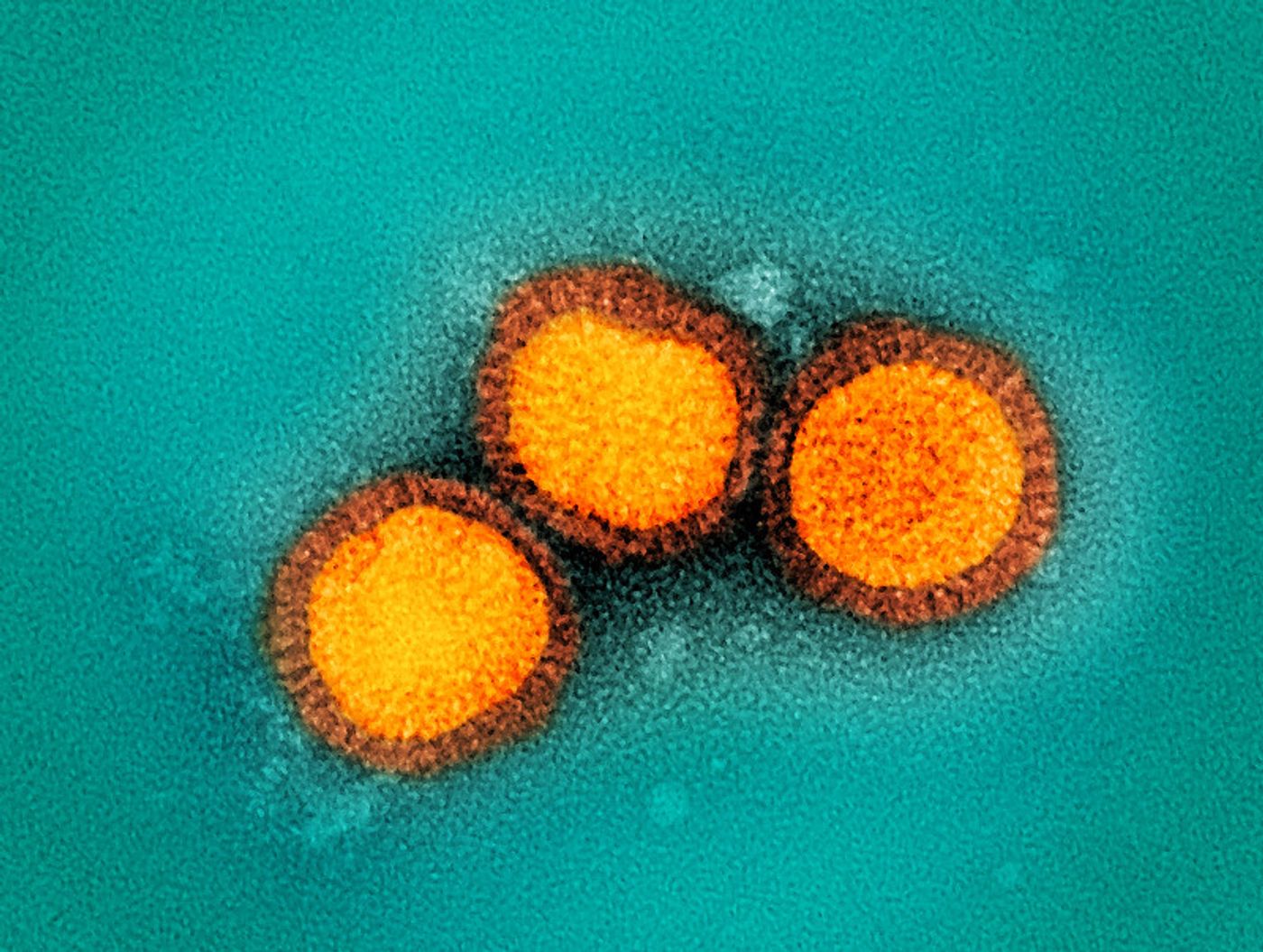 nfluenza B virus particles, colorized gold, isolated from a patient sample and then propagated in cell culture. Both influenza A and B can cause seasonal flu; however, unlike influenza A virus, which can also infect animals, influenza B only infects humans. Microscopy by John Gallagher and Audray Harris, NIAID Laboratory of Infectious Diseases. Credit: NIAID