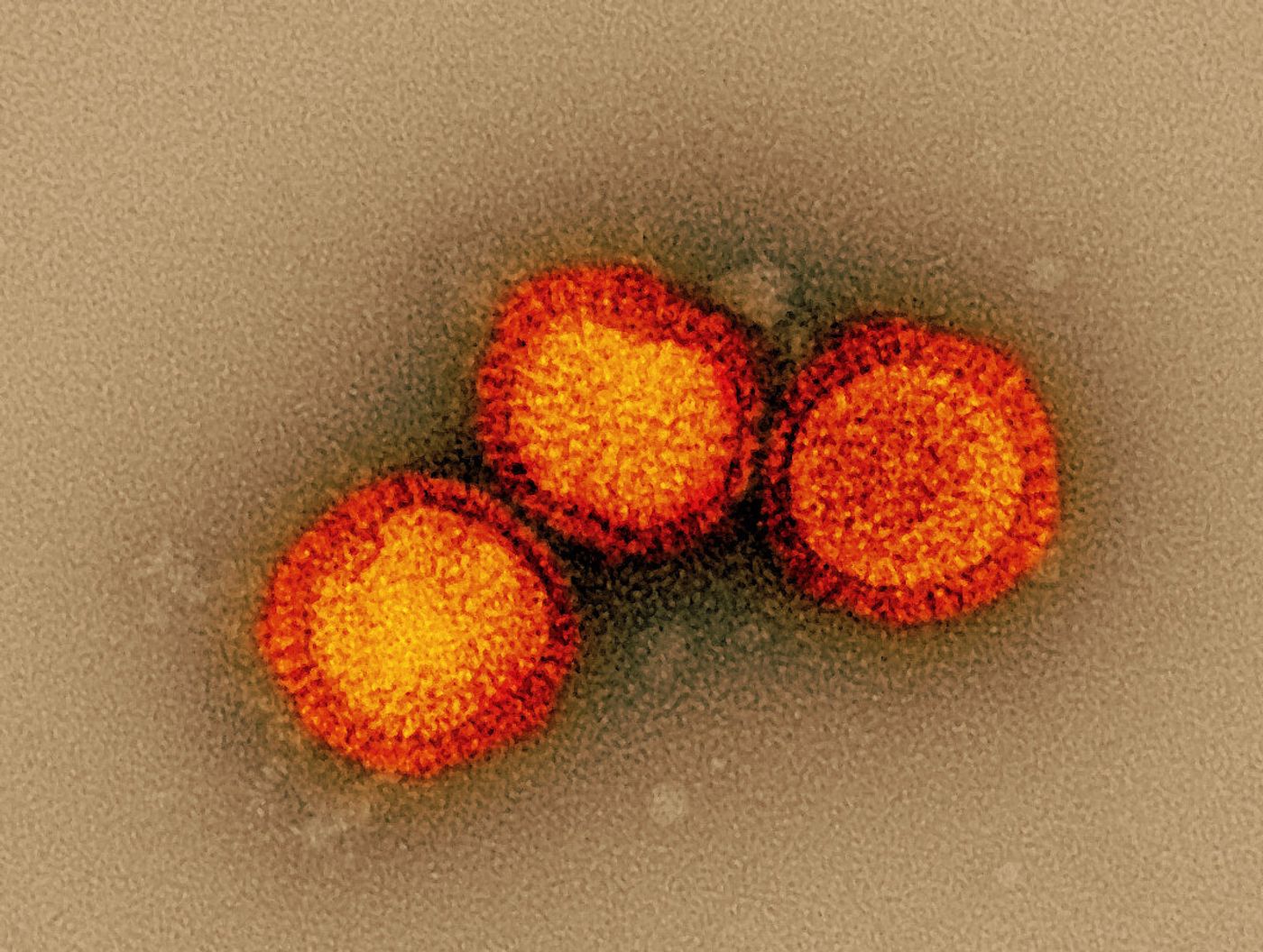 Influenza B virus particles, colorized orange, isolated from a patient sample and then propagated in cell culture. Both influenza A and B can cause seasonal flu; however, unlike influenza A virus, which can also infect animals, influenza B only infects humans. Microscopy by John Gallagher and Audray Harris, NIAID Laboratory of Infectious Diseases. Credit: NIAID