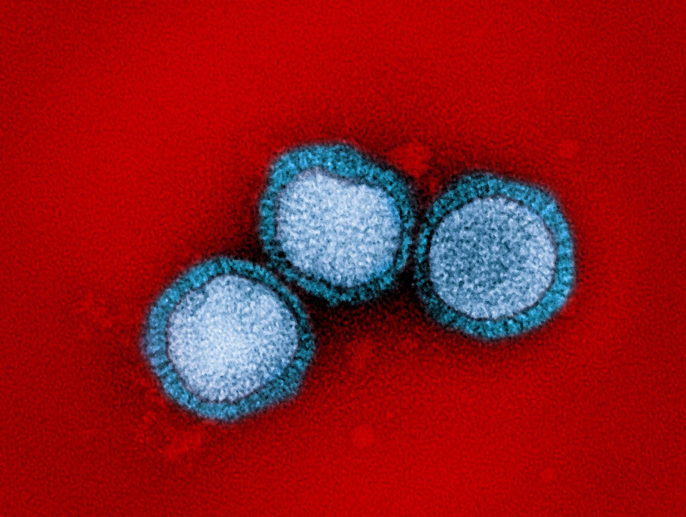 Influenza B virus particles, colorized blue, isolated from a patient sample and then propagated in cell culture. Both influenza A and B can cause seasonal flu; however, unlike influenza A virus, which can also infect animals, influenza B only infects humans. Microscopy by John Gallagher and Audray Harris, NIAID Laboratory of Infectious Diseases. Credit: NIAID