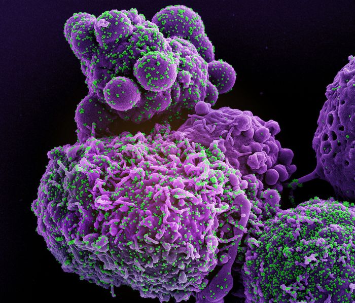 Colorized scanning electron micrograph of a cell (purple) infected with the Omicron strain of SARS-CoV-2 virus particles (green), isolated from a patient sample. Image captured at the NIAID Integrated Research Facility (IRF) in Fort Detrick, Maryland. Credit: NIAID