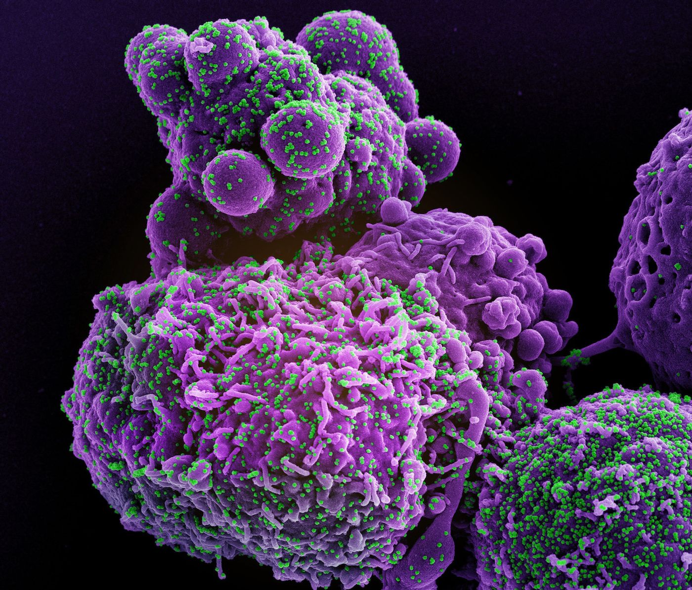 Colorized scanning electron micrograph of a cell (purple) infected with the Omicron strain of SARS-CoV-2 virus particles (green), isolated from a patient sample. Image captured at the NIAID Integrated Research Facility (IRF) in Fort Detrick, Maryland. Credit: NIAID
