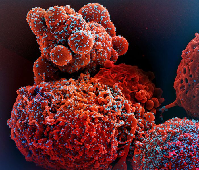 Colorized scanning electron micrograph of a cell (red) infected with the Omicron strain of SARS-CoV-2 virus particles (blue), isolated from a patient sample. Image captured at the NIAID Integrated Research Facility (IRF) in Fort Detrick, Maryland. Credit: NIAID
