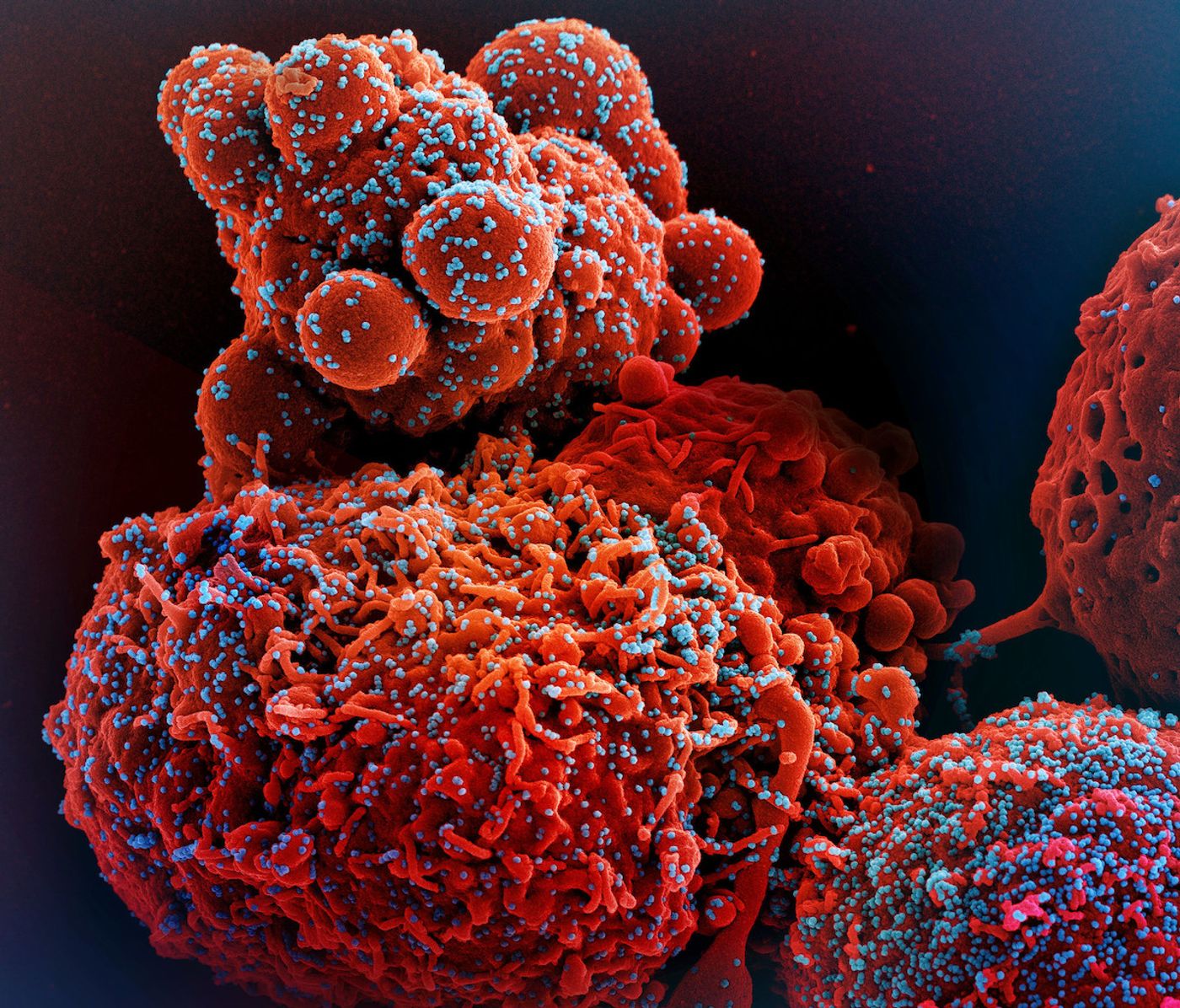 Colorized scanning electron micrograph of a cell (red) infected with the Omicron strain of SARS-CoV-2 virus particles (blue), isolated from a patient sample. Image captured at the NIAID Integrated Research Facility (IRF) in Fort Detrick, Maryland. Credit: NIAID