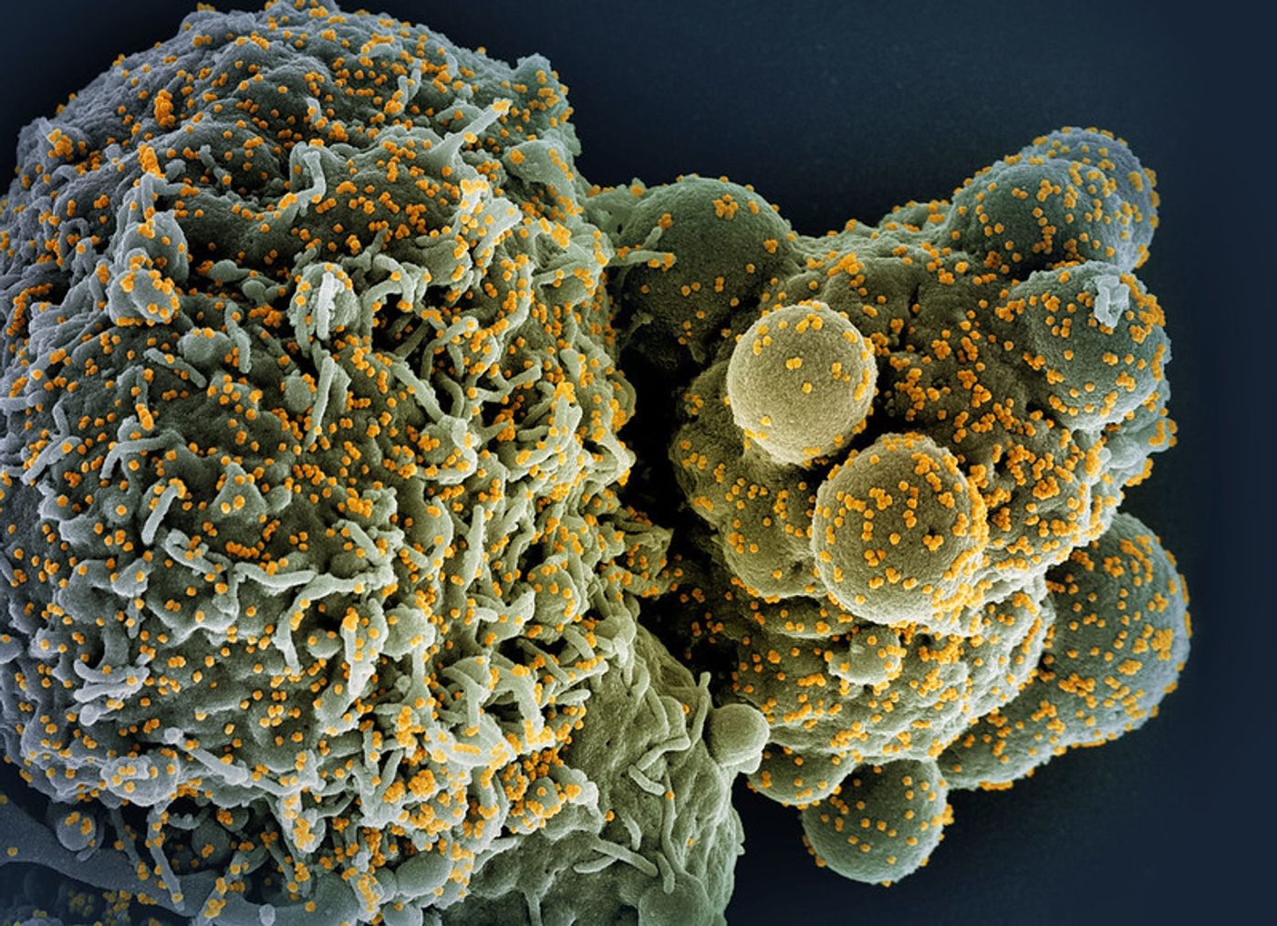 Colorized scanning electron micrograph of a cell (green) infected with the Omicron strain of SARS-CoV-2 virus particles (gold), isolated from a patient sample. Image captured at the NIAID Integrated Research Facility (IRF) in Fort Detrick, Maryland. Credit: NIAID