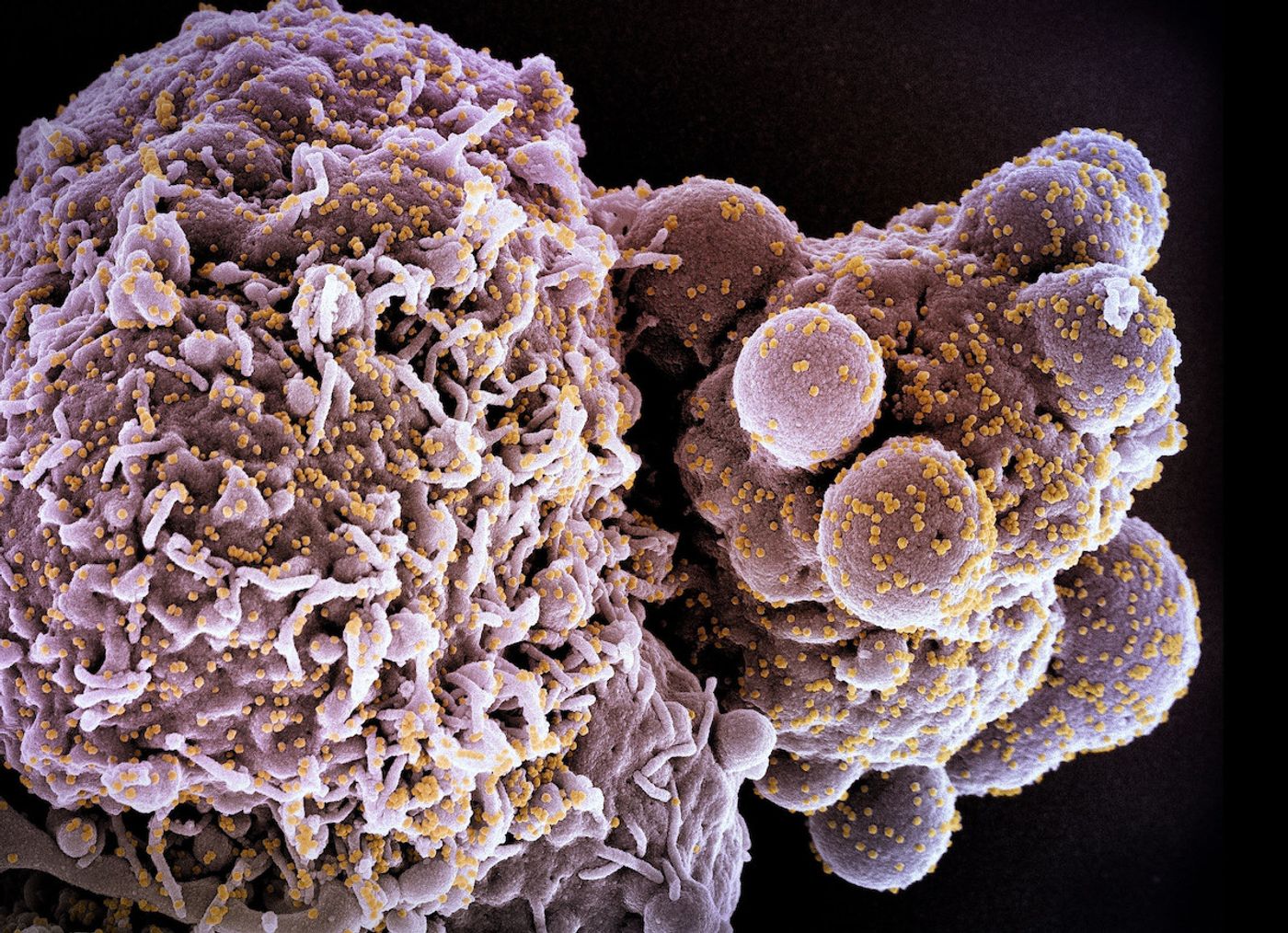 Colorized scanning electron micrograph of a cell (pink) infected with the Omicron strain of SARS-CoV-2 virus particles (yellow), isolated from a patient sample. Image captured at the NIAID Integrated Research Facility (IRF) in Fort Detrick, Maryland. Credit: NIAID