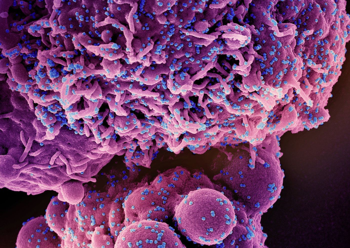 Colorized scanning electron micrograph of a cell (purple) infected with the Omicron strain of SARS-CoV-2 virus particles (blue), isolated from a patient sample. Image captured at the NIAID Integrated Research Facility (IRF) in Fort Detrick, Maryland. Credit: NIAID