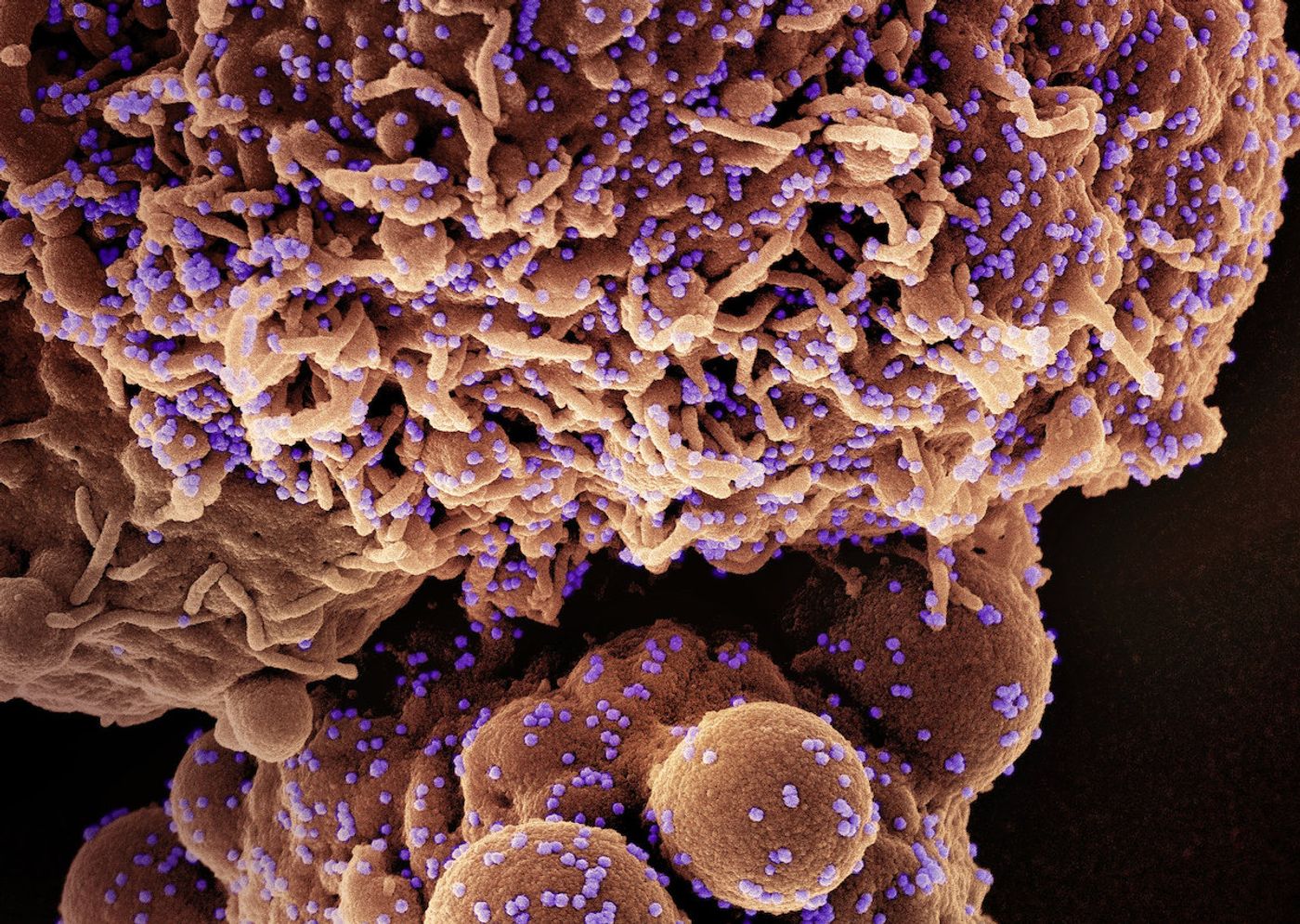 Colorized scanning electron micrograph of a cell (brown) infected with the Omicron strain of SARS-CoV-2 virus particles (purple), isolated from a patient sample. Image captured at the NIAID Integrated Research Facility (IRF) in Fort Detrick, Maryland. Credit: NIAID