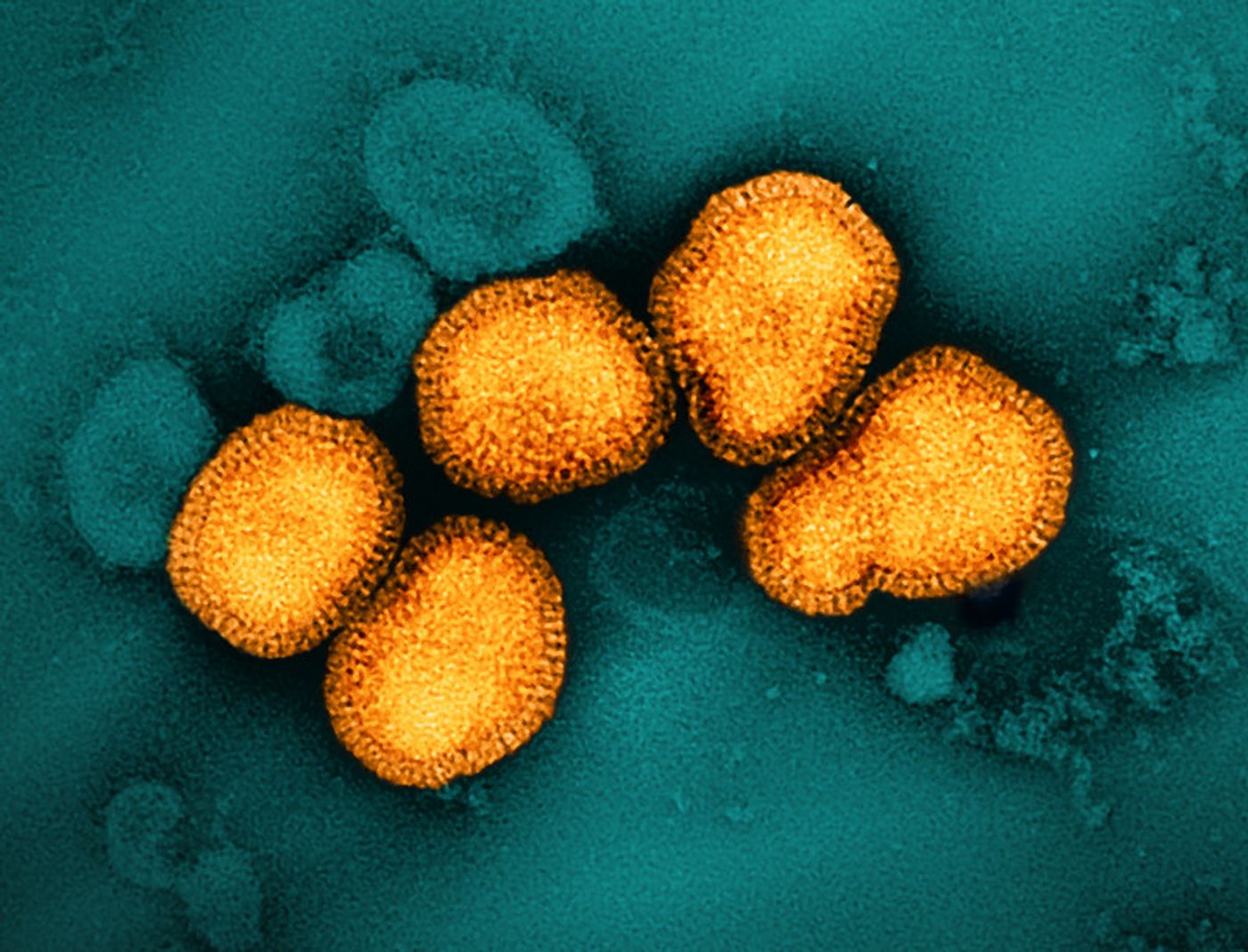 A colorized transmission electron micrograph of influenza A virus particles, colorized gold, isolated from a patient sample and then propagated in cell culture.  / Microscopy by John Gallagher and Audray Harris, NIAID Laboratory of Infectious Diseases. Credit: NIAID