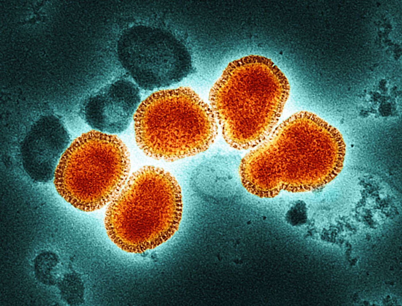 Colorized transmission electron micrograph of influenza A virus particles, colorized orange and gold, isolated from a patient sample /  NIAID Laboratory of Infectious Diseases. Credit: NIAID