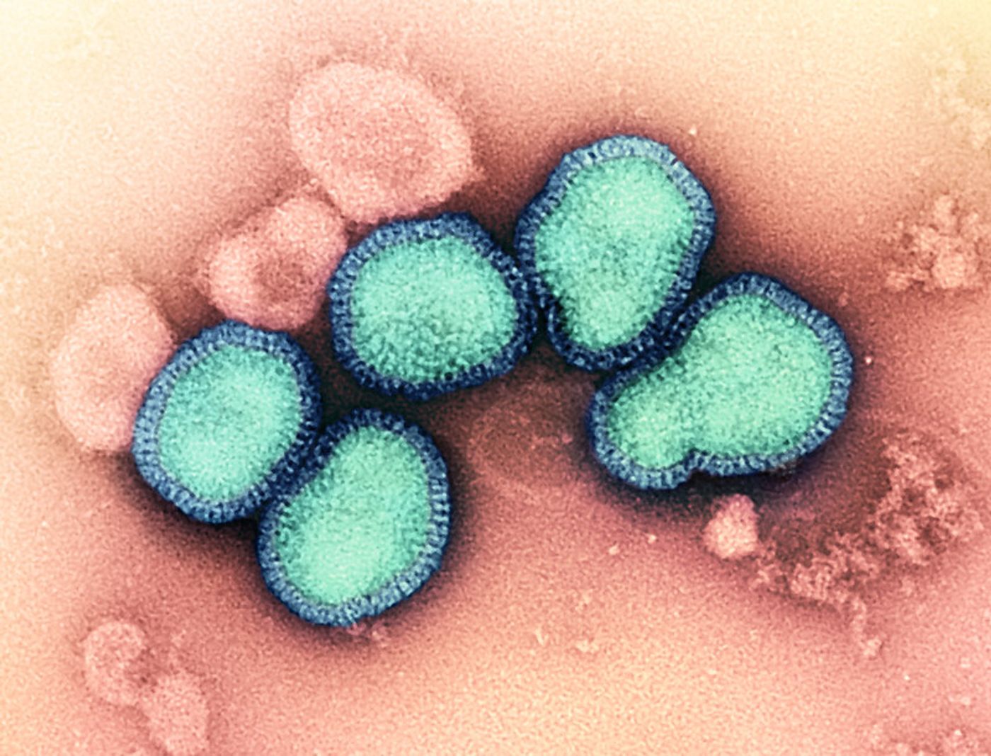  The H3N2 influenza strain, isolated from a patient in Victoria, Australia, in 1975. Historical strains can be used to study the immune response elicited by universal flu vaccine candidates. / Image credit: Microscopy by John Gallagher and Audray Harris, NIAID Laboratory of Infectious Diseases. / Credit: NIAID