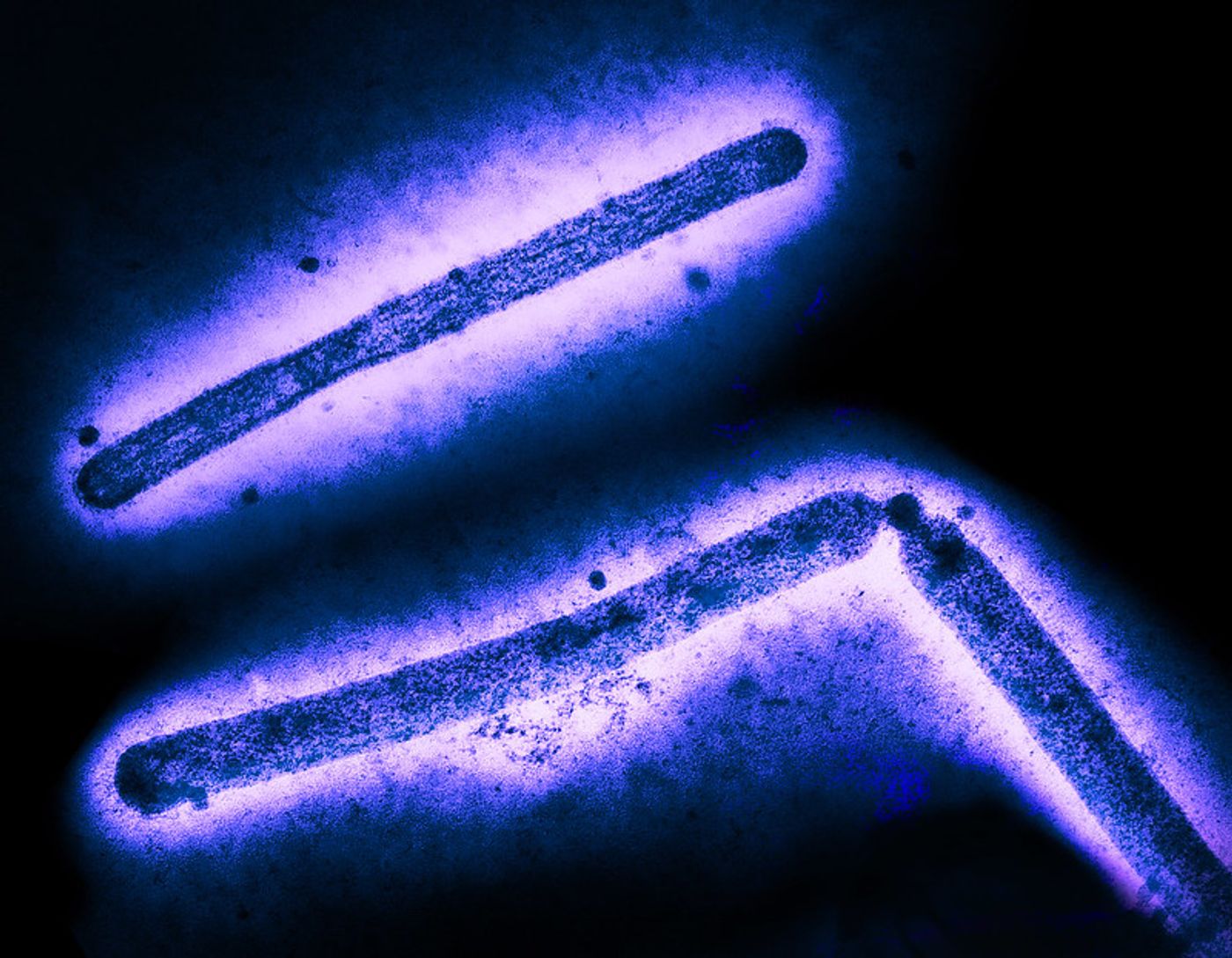 Three influenza A (H5N1/bird flu) virus particles (rod-shaped). Note: Layout incorporates two CDC transmission electron micrographs that have been inverted, repositioned, and colorized by NIAID. Scale has been modified. Credit: CDC and NIAID