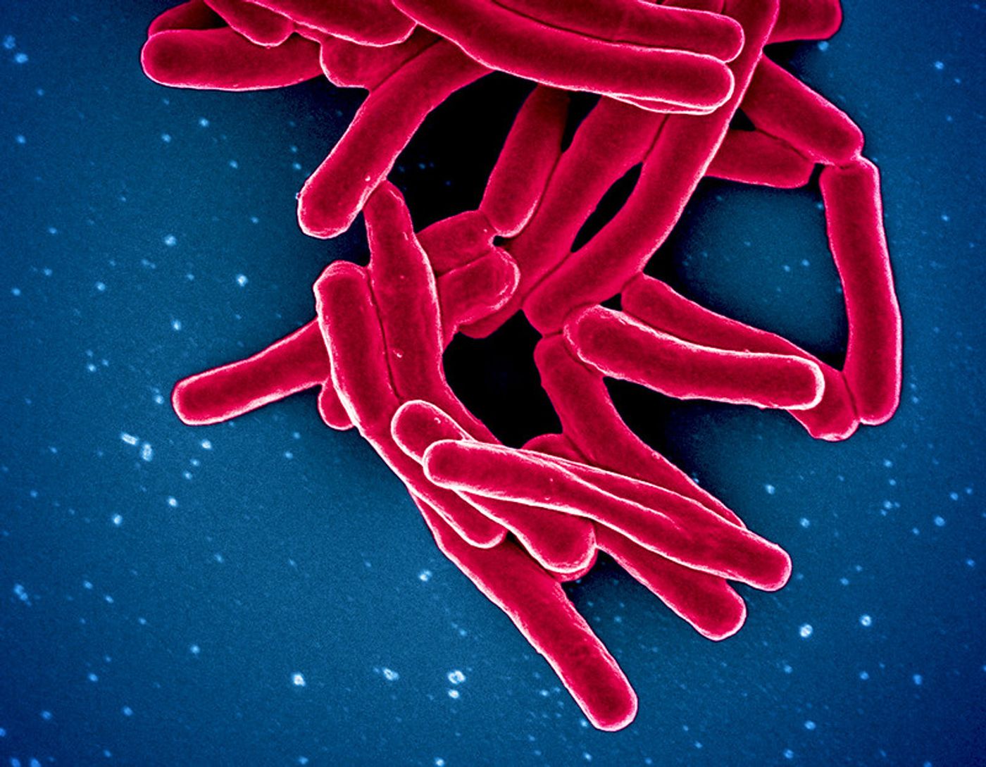 Scanning electron micrograph of Mycobacterium tuberculosis particles (colorized red), the bacterium which causes TB. Credit: NIAID