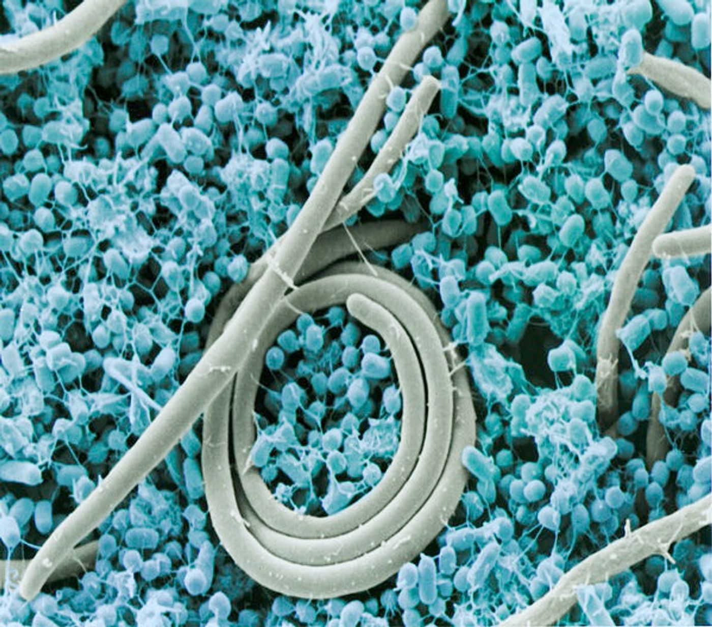 Colorized scanning electron micrograph of the foodborne pathogen Salmonella enteritidis, the most common in the United States alongside Salmonella typhimurium.