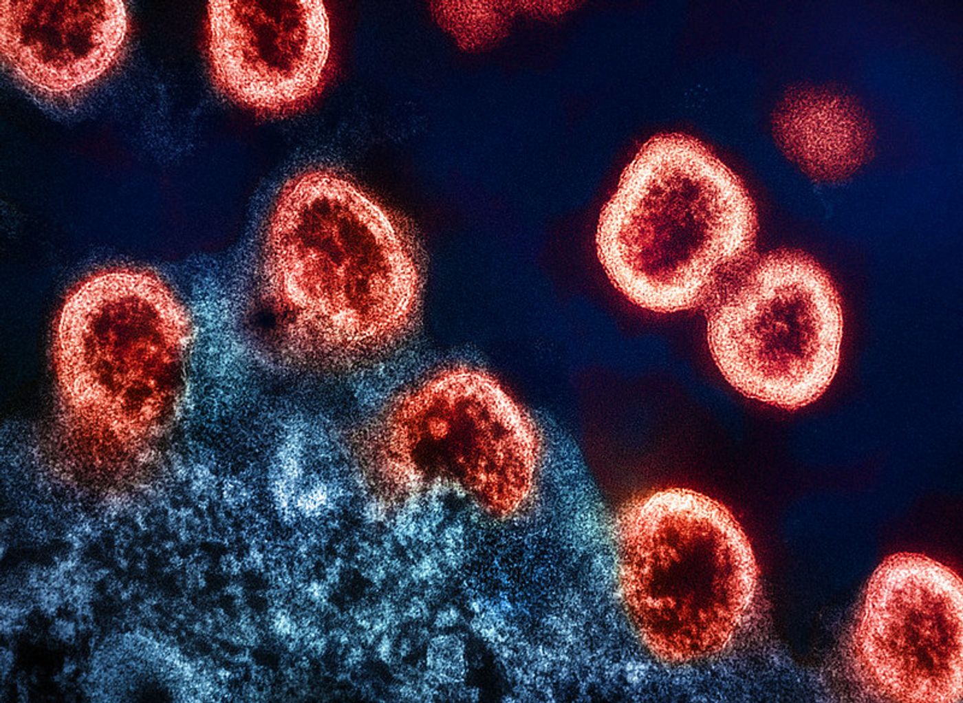   Transmission electron micrograph of HIV-1 virus particles (colorized red) replicating from an HIV-infected H9 T-cell (blue). Image captured at the NIAID Integrated Research Facility (IRF) in Fort Detrick, Maryland. / Credit: NIAID