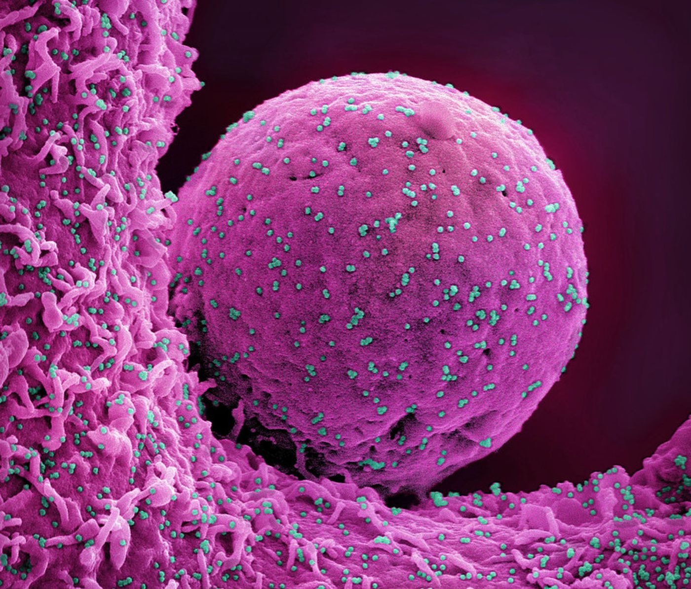 Colorized scanning electron micrograph of a cell (pink) infected with the Omicron strain of SARS-CoV-2 virus particles (teal), isolated from a patient sample. Image captured at the NIAID Integrated Research Facility (IRF) in Fort Detrick, Maryland. Credit: NIAID