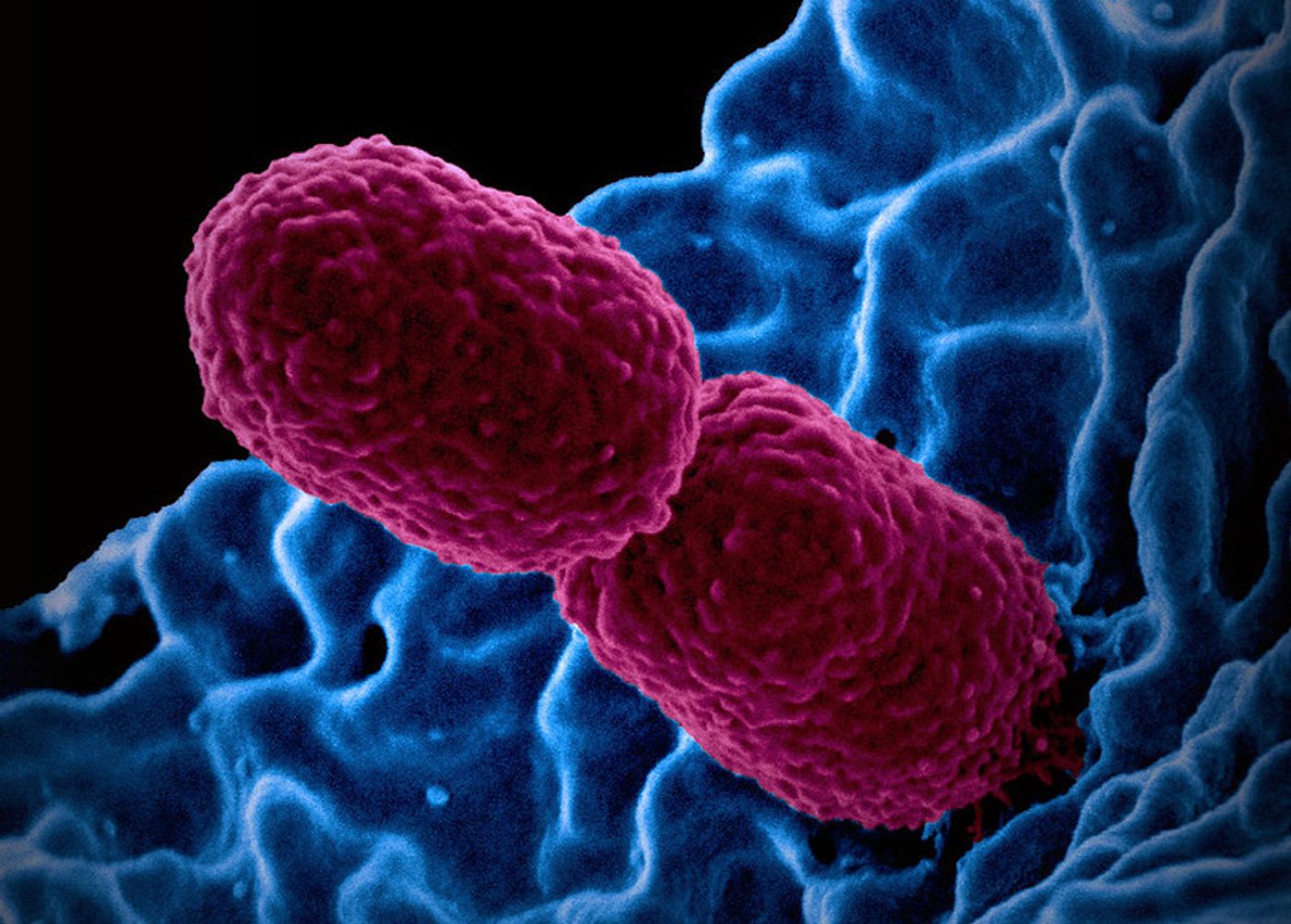 Colorized scanning electron micrograph showing carbapenem-resistant Klebsiella pneumoniae (pink) interacting with a human neutrophil. Image captured at NIAID's Rocky Mountain Laboratories (RML) in Hamilton, Montana. Credit: NIAID