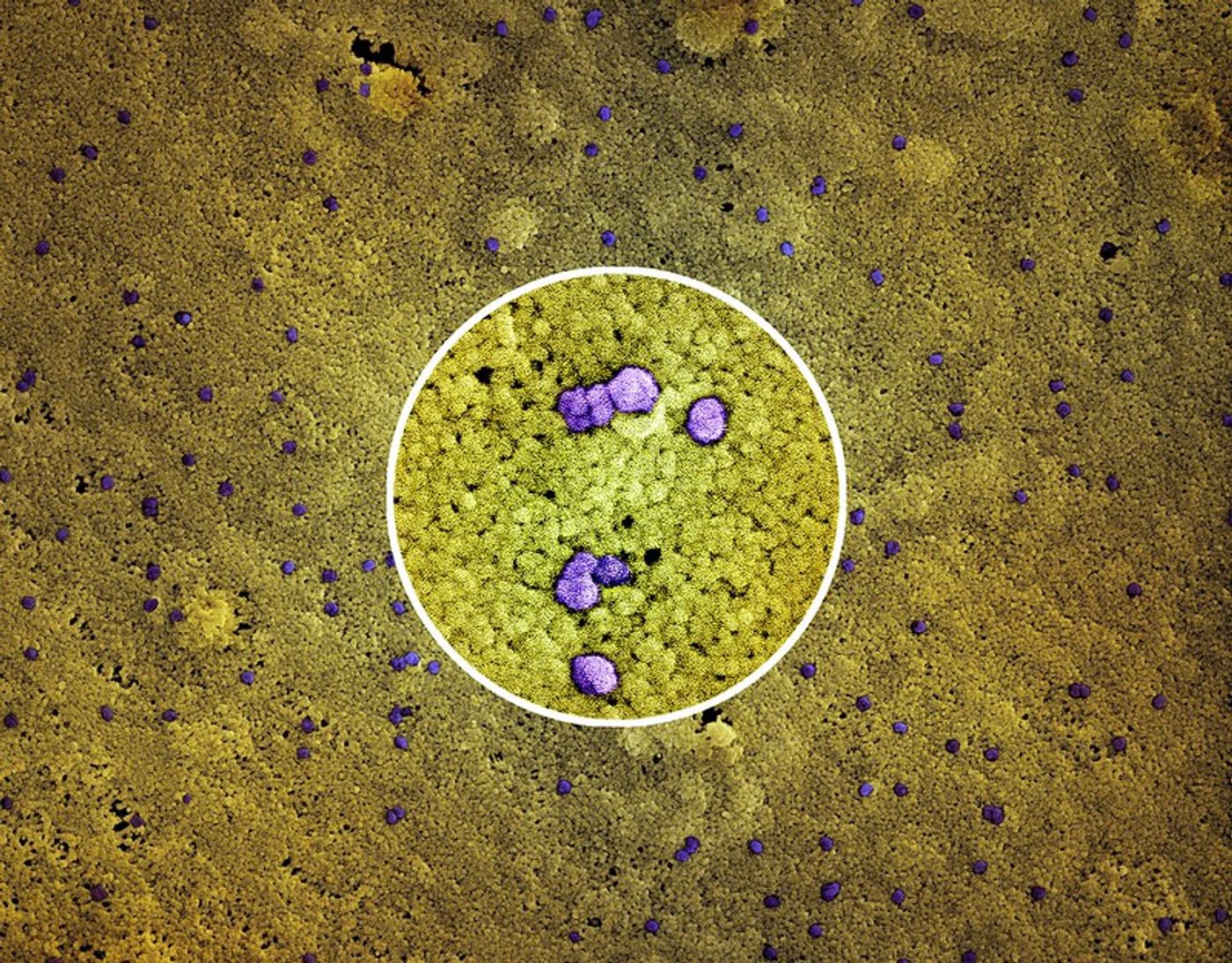 Colorized scanning electron micrograph of a VERO E6 cell (yellow/green) infected with the Omicron strain of SARS-CoV-2 virus particles (purple), isolated from a patient sample. A close-up image of virus particles is featured center. Captured at the NIAID Integrated Research Facility (IRF) in Fort Detrick, Maryland. Credit: NIAID