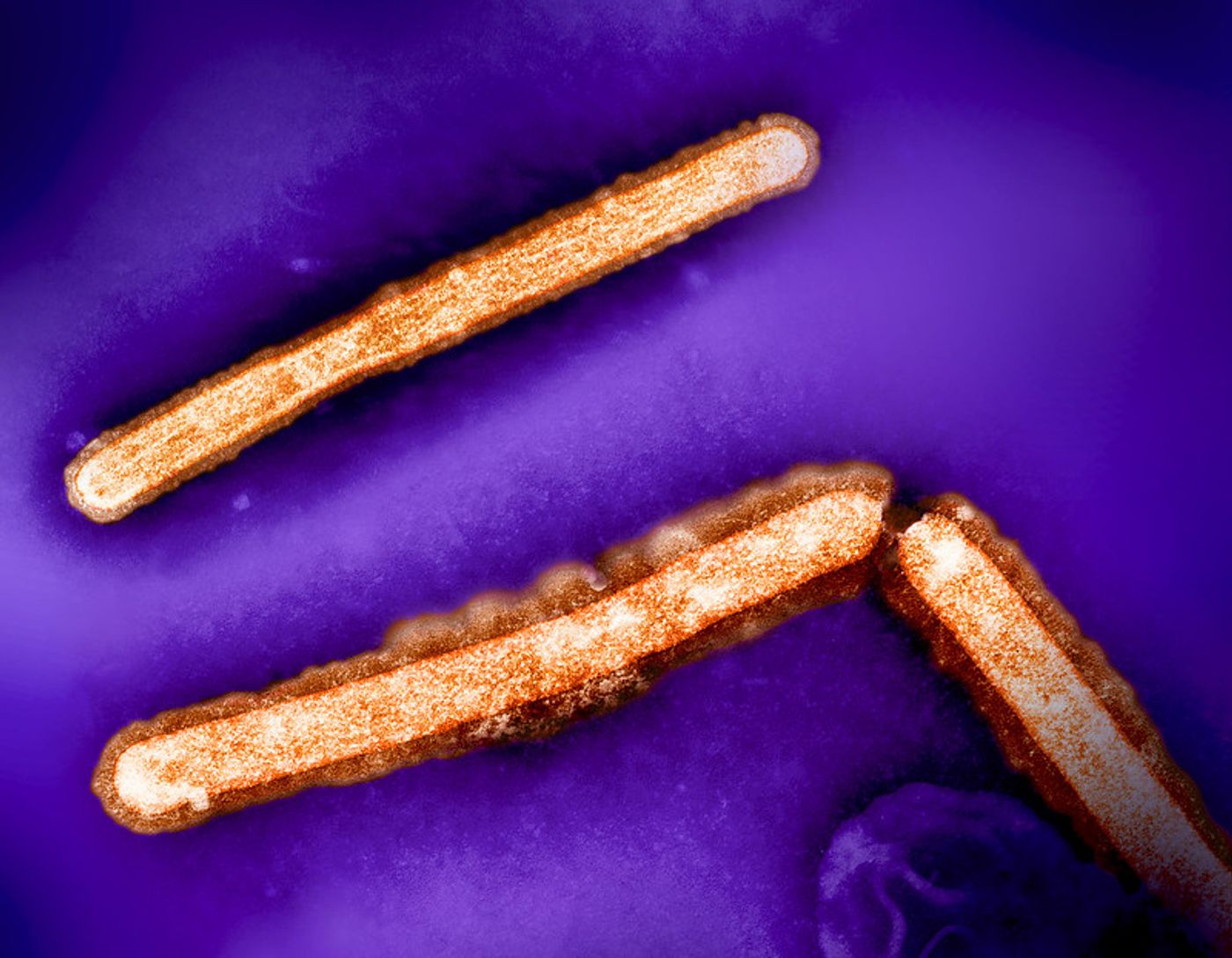 Three influenza A (H5N1/bird flu) virus particles (rod-shaped; orange). Note: Layout incorporates two CDC transmission electron micrographs that have been repositioned and colorized by NIAID. Scale has been modified. Credit: CDC and NIAID