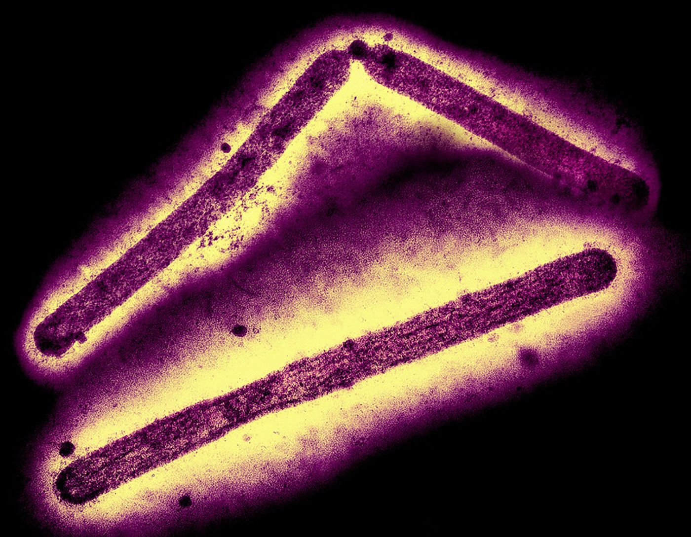 Three influenza A (H5N1/bird flu) virus particles (rod-shaped; purple). Note: Layout incorporates two CDC transmission electron micrographs that have been inverted, repositioned, and colorized by NIAID. Scale has been modified. Credit: CDC and NIAID