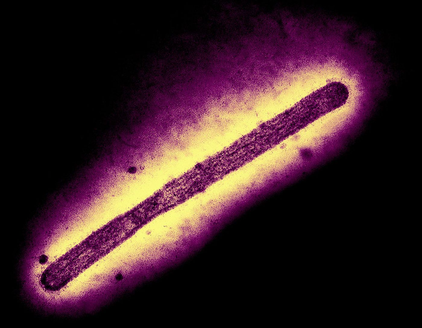 Transmission electron microscope image of an influenza A H5N1/bird flu virion. Note: micrograph image is by CDC; visual effects by NIAID. / Credit: CDC and NIAID